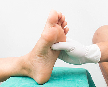 Diabetic Foot